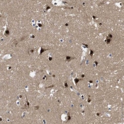 ZBTB46 Antibody, Novus Biologicals 0.1mL; Unlabeled:Antibodies, Polyclonal